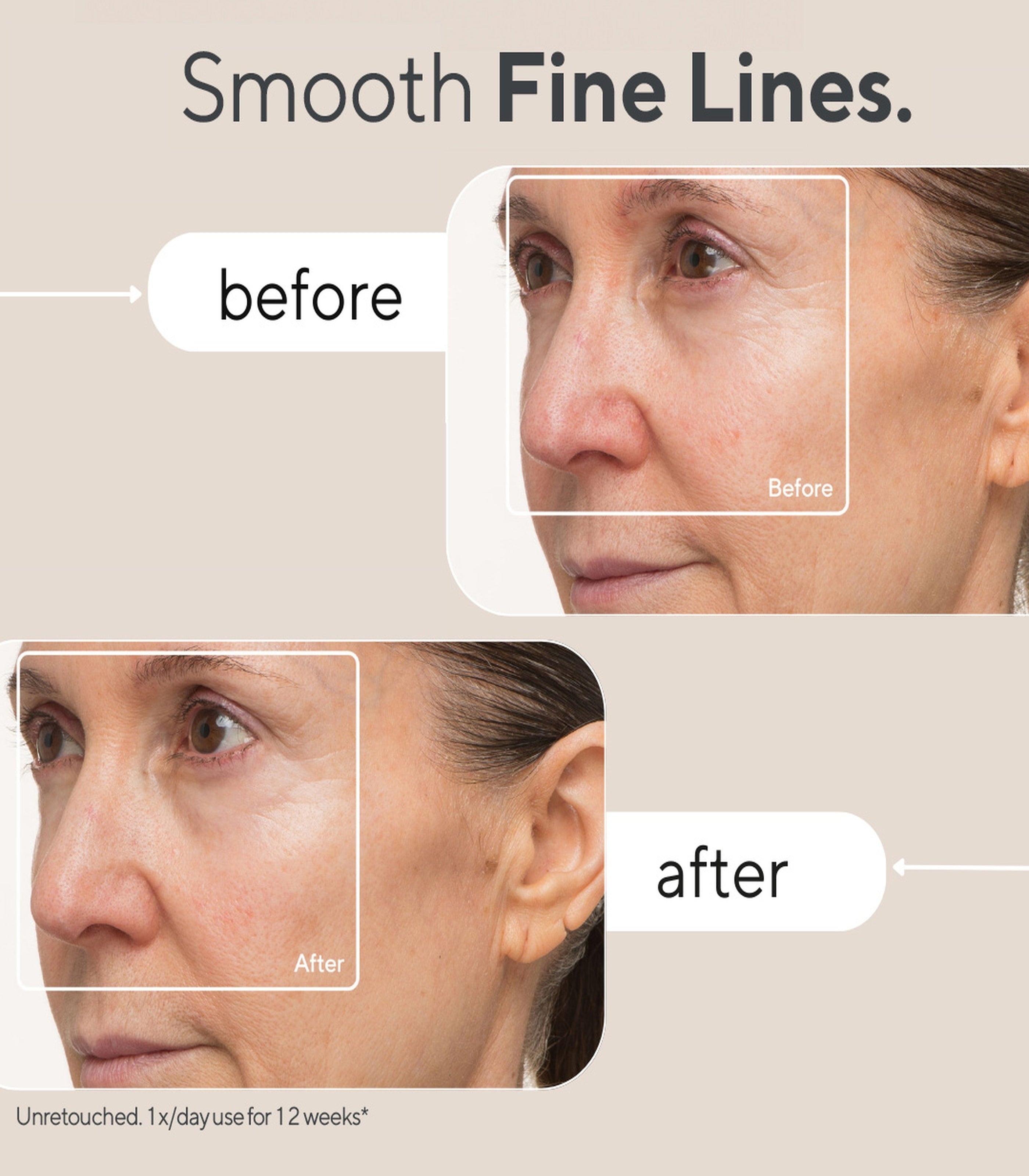 THERABODYThera Face Mask Wellness Gadget/Device