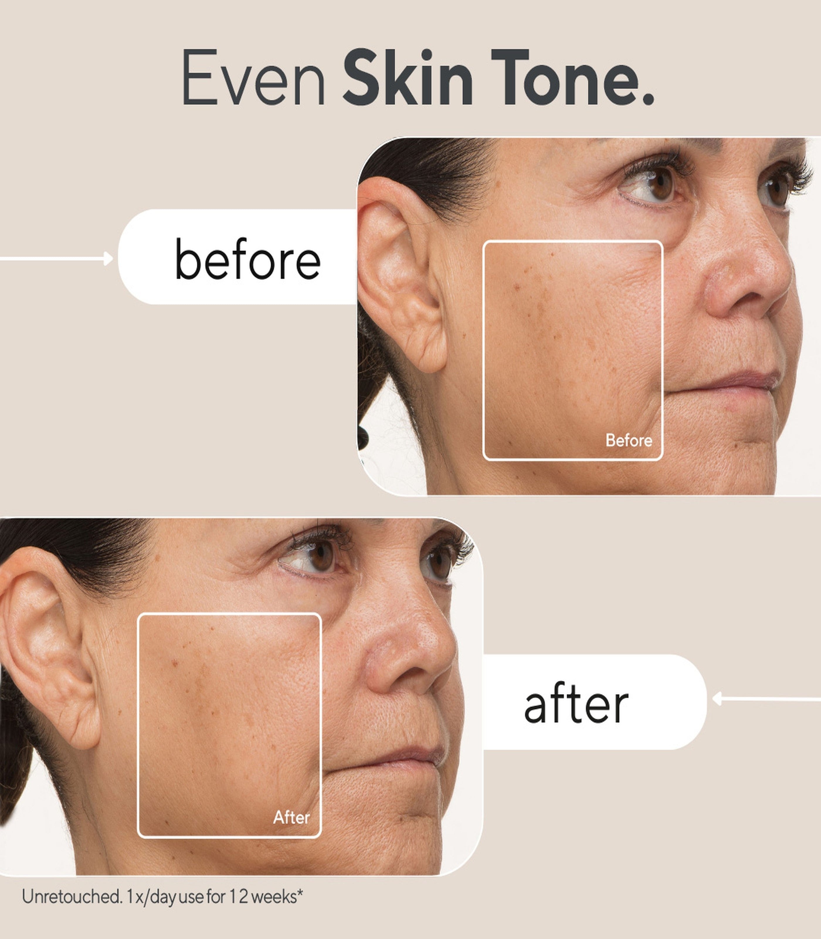 THERABODYThera Face Mask Wellness Gadget/Device
